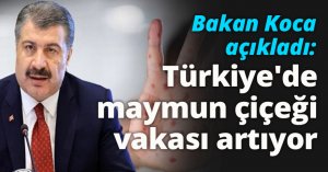 Bakan Koca açıkladı: Türkiye'de maymun çiçeği vakası artıyor