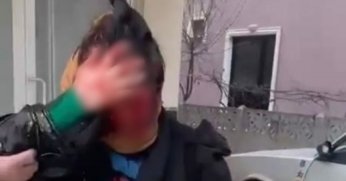 Sokak ortasında aldığı bıçak darbeleriyle yüzü kanlar içinde kaldı