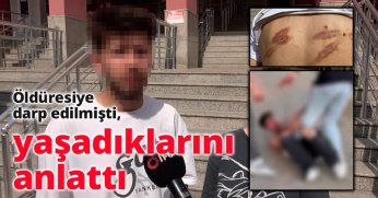 Öldüresiye darp edilmişti, yaşadıklarını anlattı