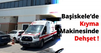 Başiskele’de Kıyma Makinesinde Dehşet: Genç Kadının Parmakları Koptu!