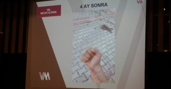  54 saat sonra gelen kopmuş parmakta bile umut olabiliyor