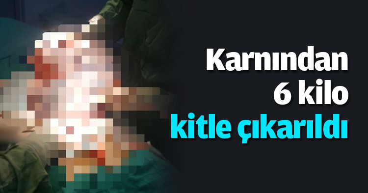 Karnından 6 kilo kitle çıkarıldı