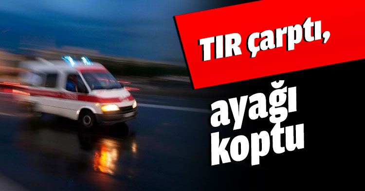TIR çarptı, ayağı koptu