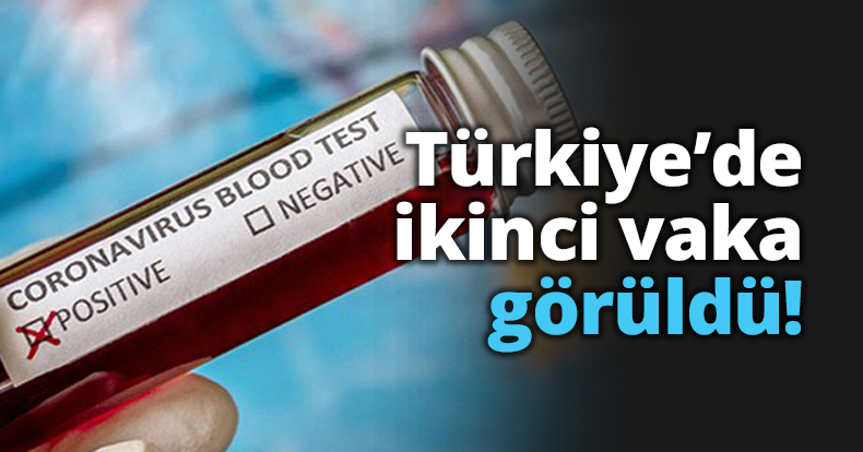 Türkiye’de ikinci vaka görüldü!