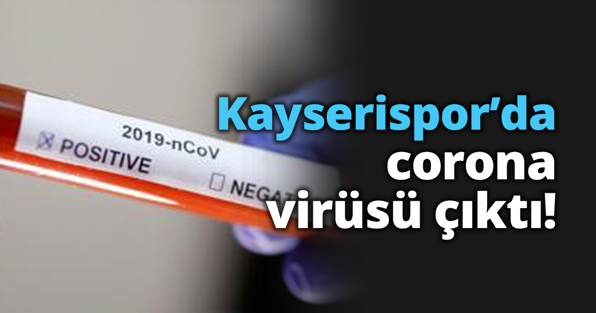 Kayserispor’da corona virüsü çıktı!