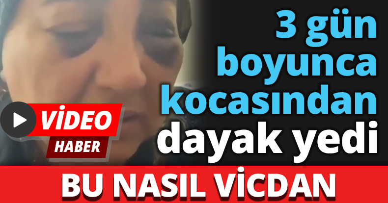BU NASIL VİCDAN 3 gün boyunca kocasından dayak yedi