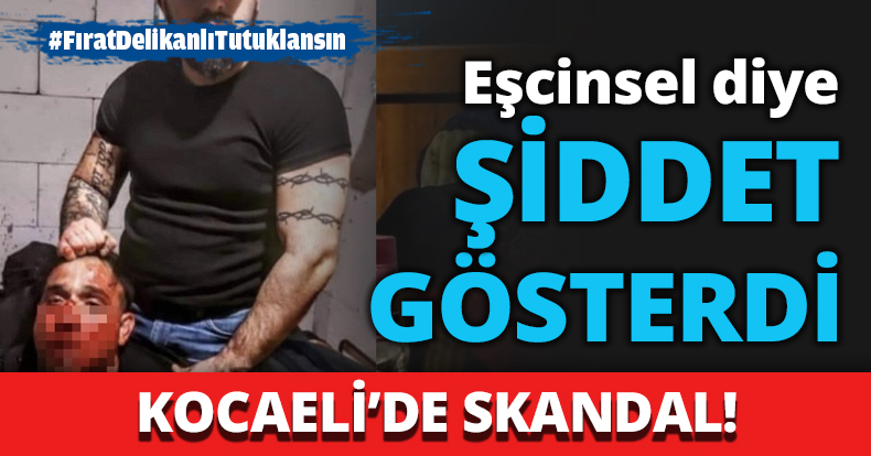 Eşcinsel diye şiddet gösterdi!