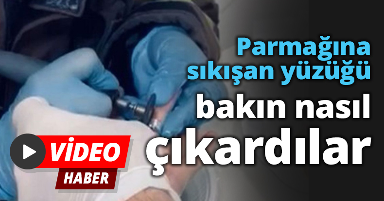 Parmağına sıkışan yüzüğü bakın nasıl çıkardılar