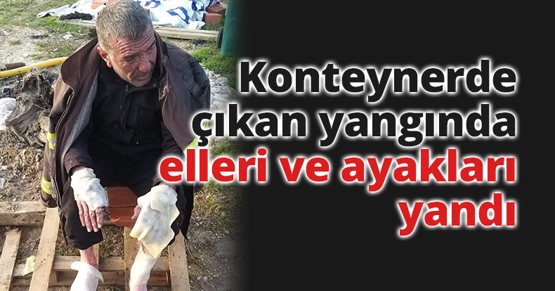 Konteynerde çıkan yangında elleri ve ayakları yandı