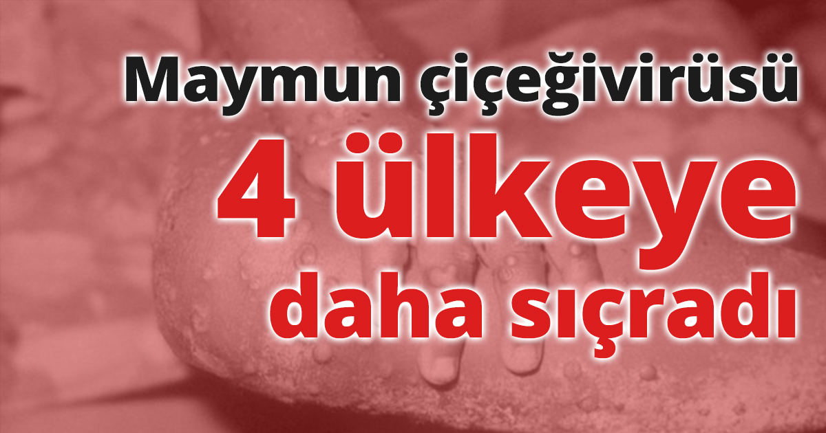 Maymun çiçeği virüsü 4 ülkeye daha sıçradı