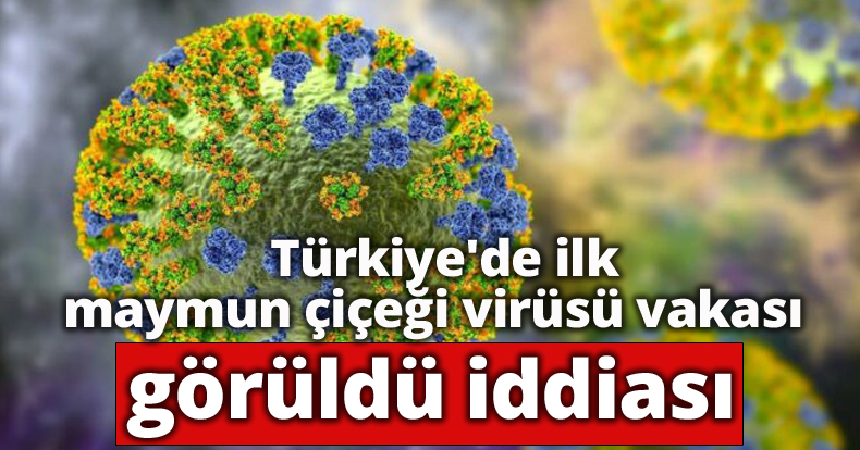 Türkiye'de ilk maymun çiçeği virüsü vakası görüldü iddiası