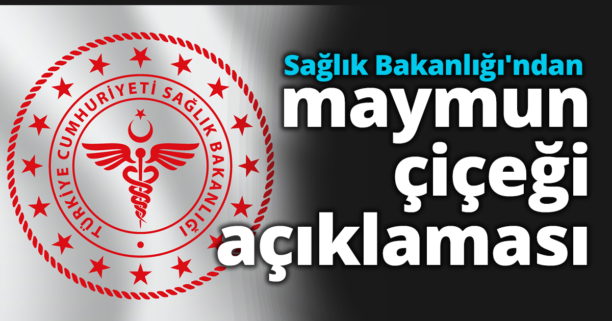 Sağlık Bakanlığı'ndan maymun çiçeği açıklaması