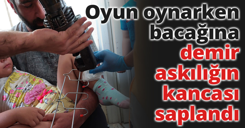 Oyun oynarken bacağına demir askılığın kancası saplandı