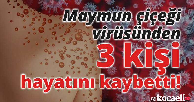Maymun çiçeği virüsünden 3 kişi hayatını kaybetti