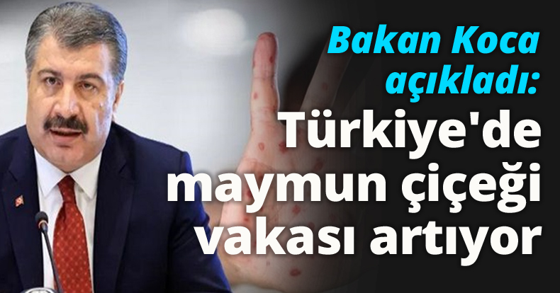 Bakan Koca açıkladı: Türkiye'de maymun çiçeği vakası artıyor