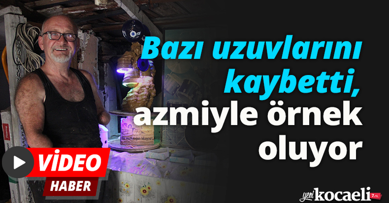 Bazı uzuvlarını kaybetti, azmiyle örnek oluyor