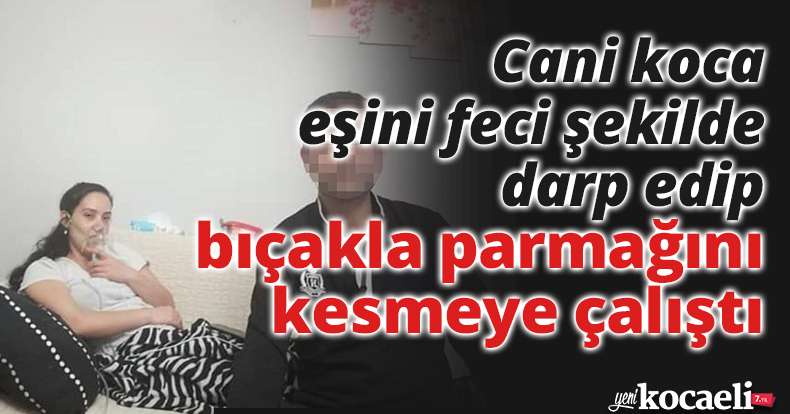 Gözü dönen koca eşini feci şekilde darp edip, bıçakla parmağını kesmeye çalıştı