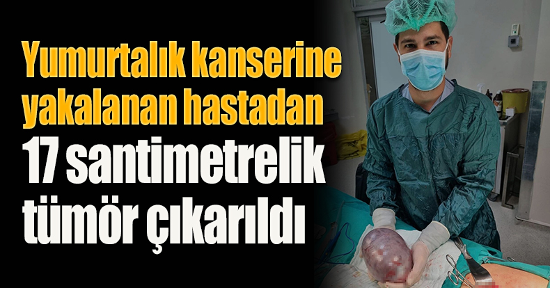 Yumurtalık kanserine yakalanan hastadan 17 santimetrelik tümör çıkarıldı