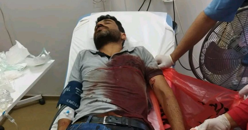 ÇALIŞIRKEN KÖPEK SALDIRISINA UĞRADI HASTANELİK OLDU!