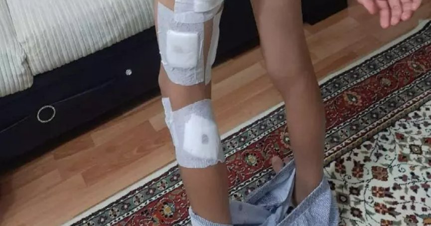 Başıboş köpek terörü bitmek bilmiyor! Küçük çocuğa dehşeti yaşattılar