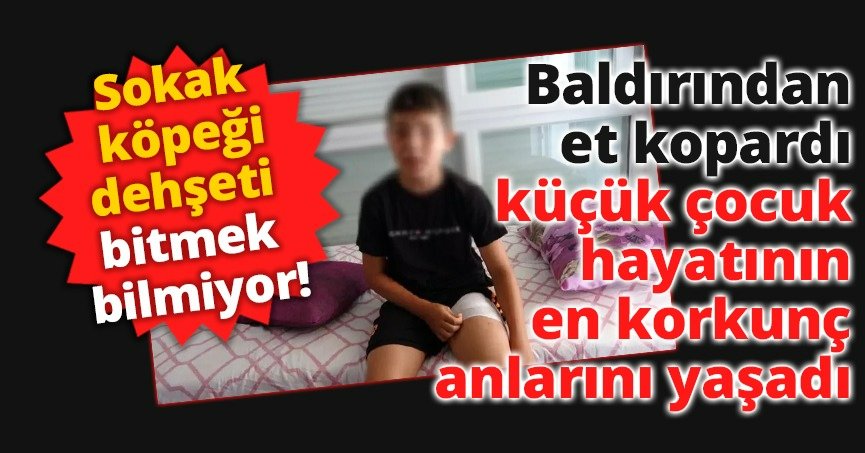 Baldırından et kopardı, küçük çocuk hayatının en korkunç anlarını yaşadı