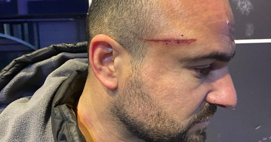  İşe gitmek için otomobiline bindi, dehşeti yaşadı