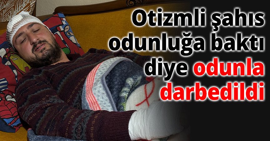 Otizmli şahıs odunluğa baktı diye odunla darbedildi