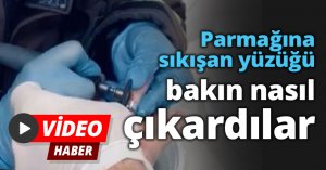 Parmağına sıkışan yüzüğü bakın nasıl çıkardılar