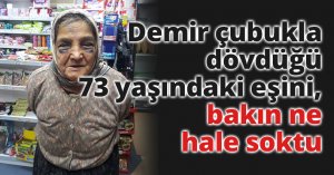 Demir çubukla dövdüğü 73 yaşındaki eşini, bakın ne hale soktu