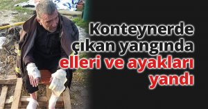 Konteynerde çıkan yangında elleri ve ayakları yandı