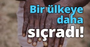 Bir ülkeye daha sıçradı!