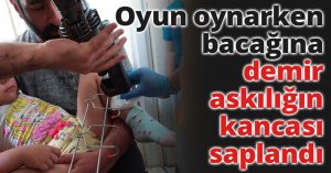 Oyun oynarken bacağına demir askılığın kancası saplandı