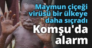 Maymun çiçeği virüsü bir ülkeye daha sıçradı: Komşu'da alarm