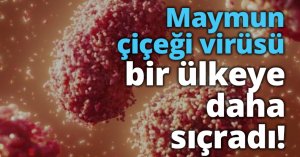 Maymun çiçeği virüsü bir ülkeye daha sıçradı