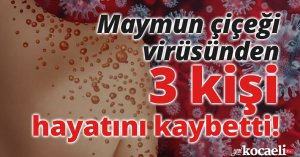 Maymun çiçeği virüsünden 3 kişi hayatını kaybetti