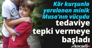 Kör kurşunla yaralanan minik Musa'nın vücudu tedaviye tepki vermeye başladı