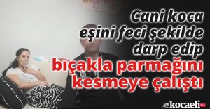 Gözü dönen koca eşini feci şekilde darp edip, bıçakla parmağını kesmeye çalıştı