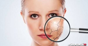 Hassas cildi olanlar aman dikkat