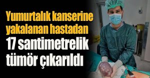 Yumurtalık kanserine yakalanan hastadan 17 santimetrelik tümör çıkarıldı