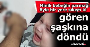 Minik bebeğin parmağı öyle bir yere sıkıştı ki gören şaşkına döndü