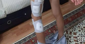 Başıboş köpek terörü bitmek bilmiyor! Küçük çocuğa dehşeti yaşattılar