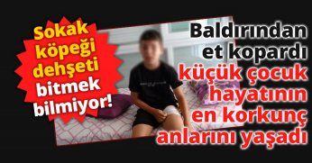 Baldırından et kopardı, küçük çocuk hayatının en korkunç anlarını yaşadı