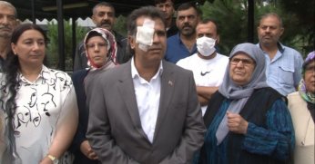 Sağ gözünde yüzde 60 görme kaybı oluştu, yine de şikayetçi olmadı