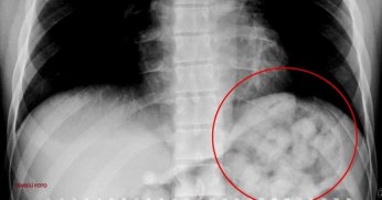 Uyuşturucu kuryesinin feci ölümü